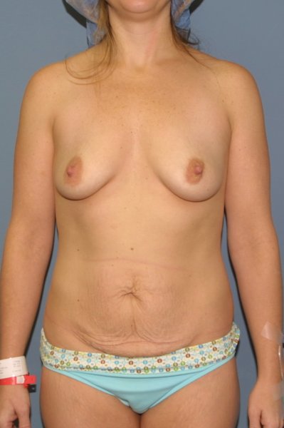 Photograph before the surgery