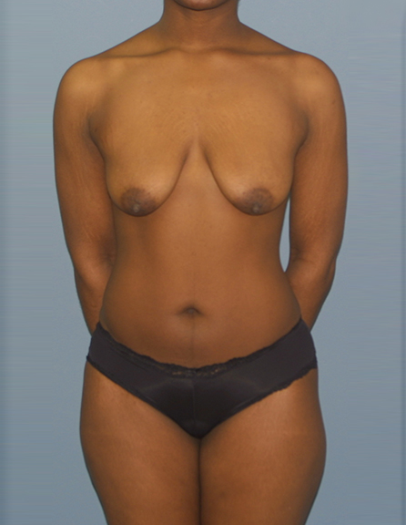Before the operation