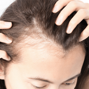 Cosmetic Procedure Hair Transplants Can Now Transform Your Life