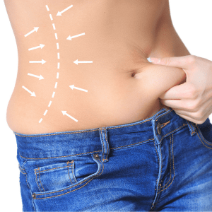 vibration supported liposuction