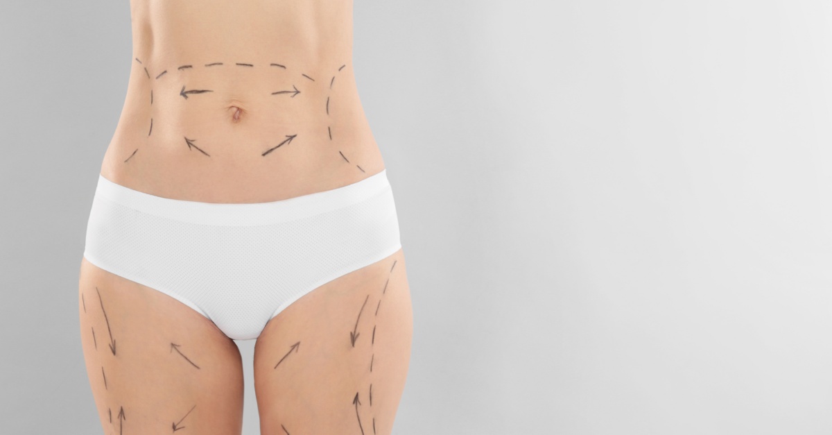 Dr. Trussler Liposuction Cost Austin